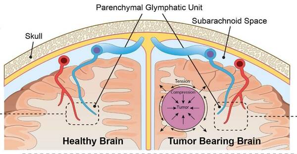 glymphatics