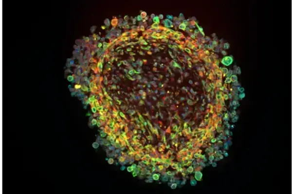 organoid